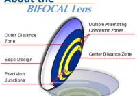 bifocal contact lenses