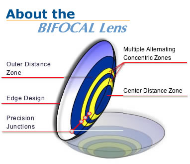 bifocal contact lenses