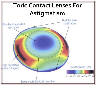 Benefits-Of-Wearing-Toric-Contact-Lenses