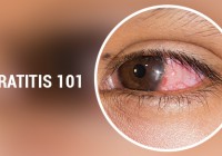 Symptoms of Keratitis